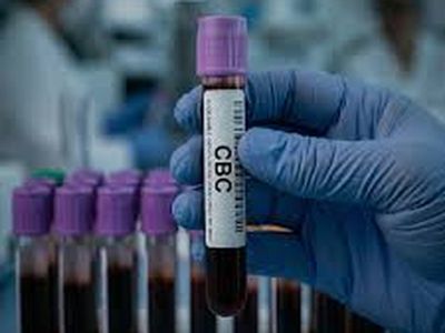 CBC sample