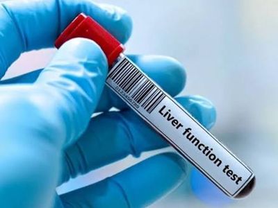 Liver Function (LFT's) sample