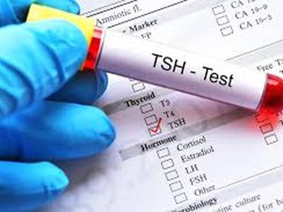 TSH sample